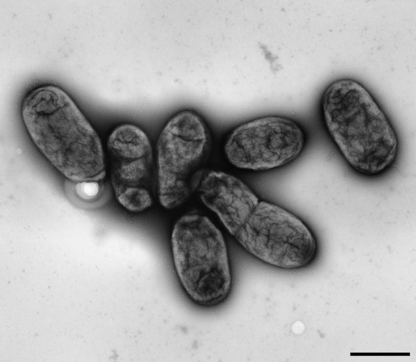 La bacteria Yersinia pestis es el agente causante de la peste.